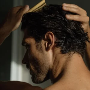 erkeklerde saç dökülmesi