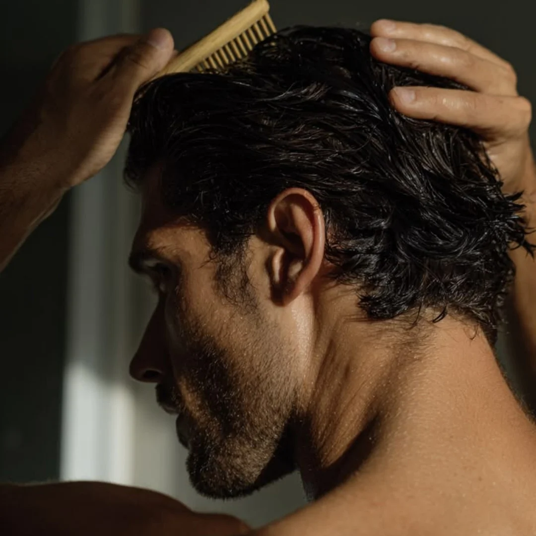 erkeklerde saç dökülmesi